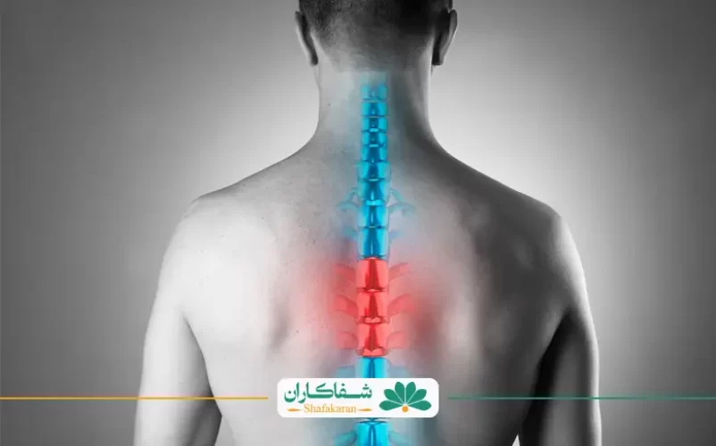 علت درد ستون فقرات بالای کمر