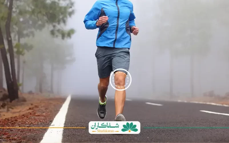 بی حسی زانو | شفاکاران