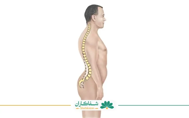 گودی کمر و افزایش قد | شفاکاران