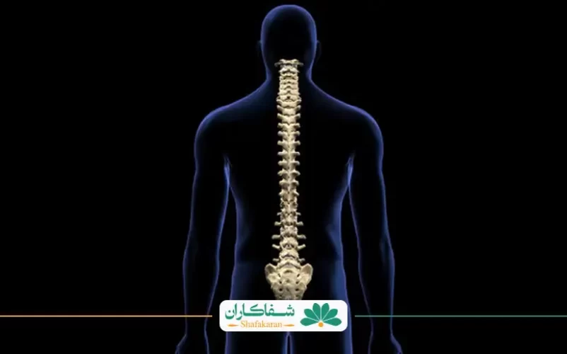 علائم سیاتیک | شفاکاران