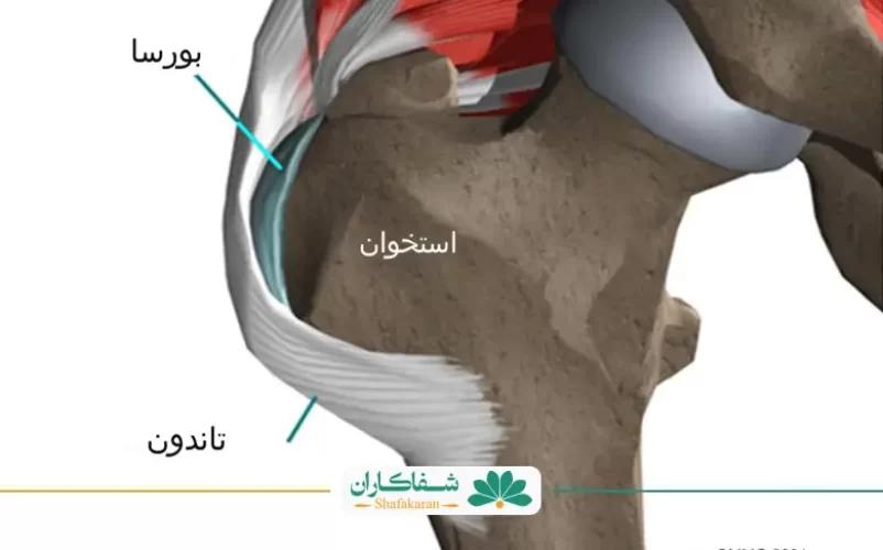 بورسیت لگن | شفاکاران