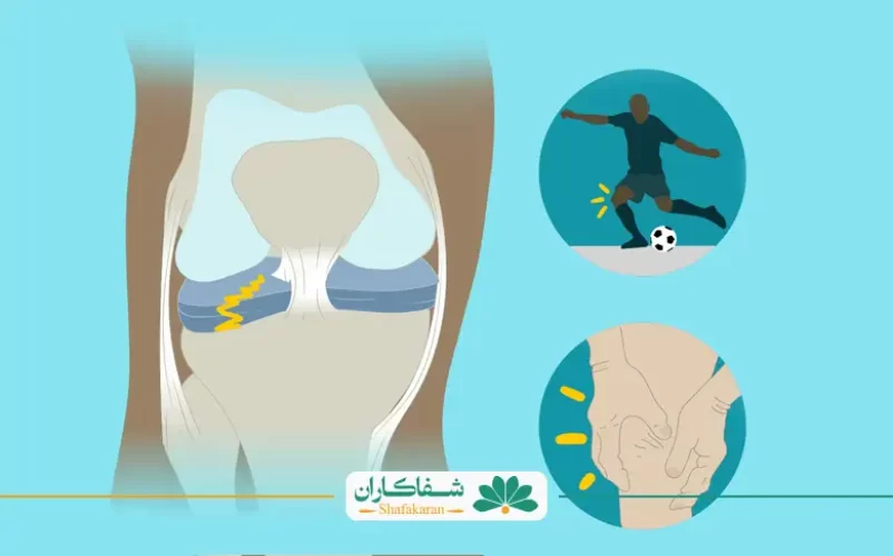 حرکات_مضر_برای_مینیسک_زانو | شفاکاران