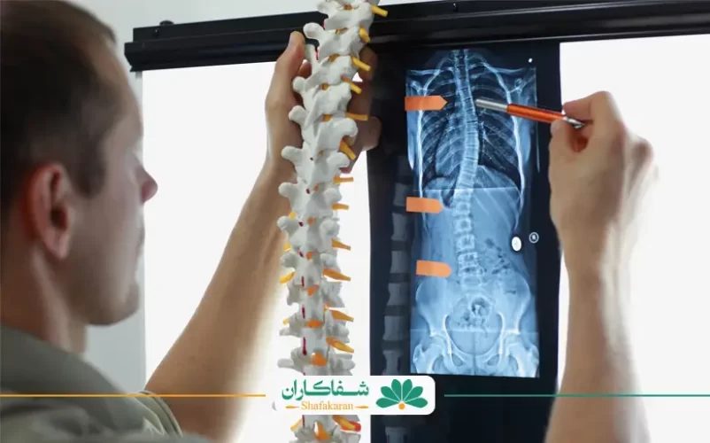 روش های تشخیص دیسک کمر با تصوری از ستون مهره‌ها | شفاکاران