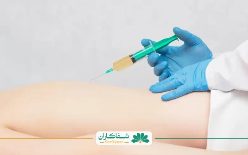 پی آر پی کمر | شفاکاران