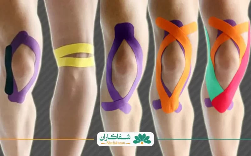 چسب زانو درد | شفاکاران
