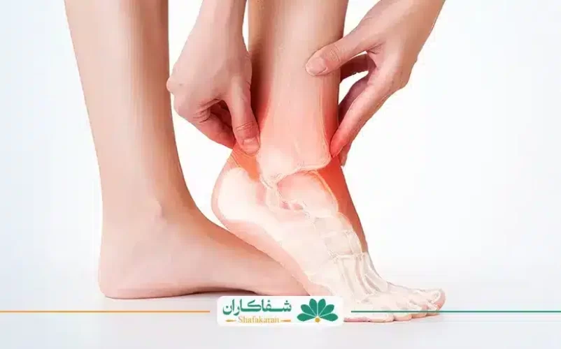 سیاتیک و درد مچ پا | شفاکاران