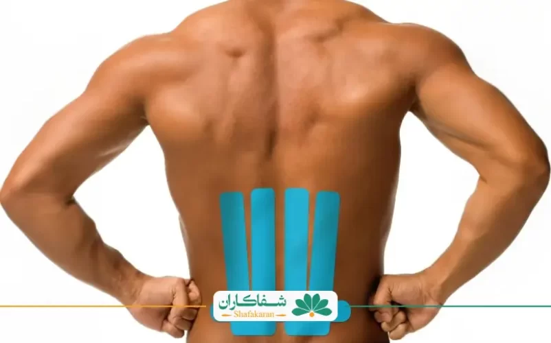 چسب کمر برای سیاتیک | شفاکاران
