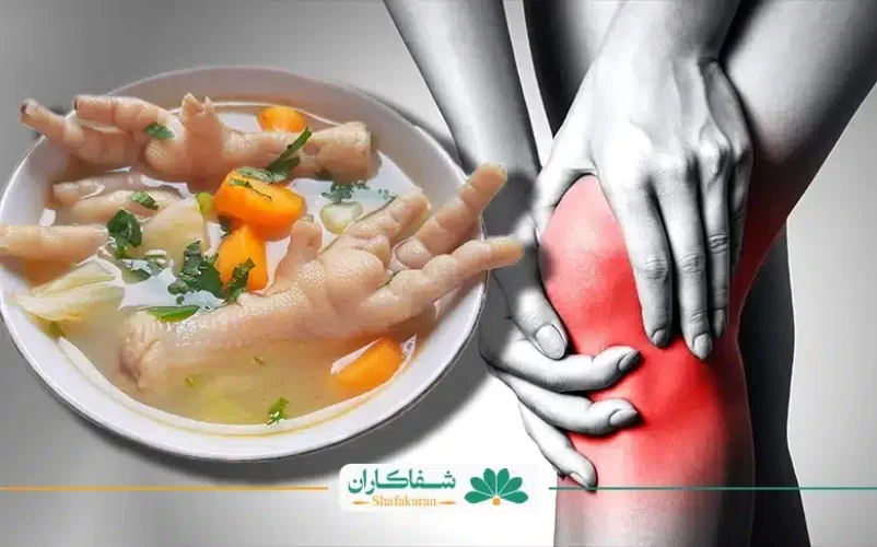پای مرغ برای زانو درد | شفاکاران