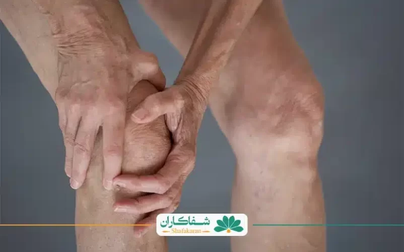 انواع روماتیسم | شفاکاذان