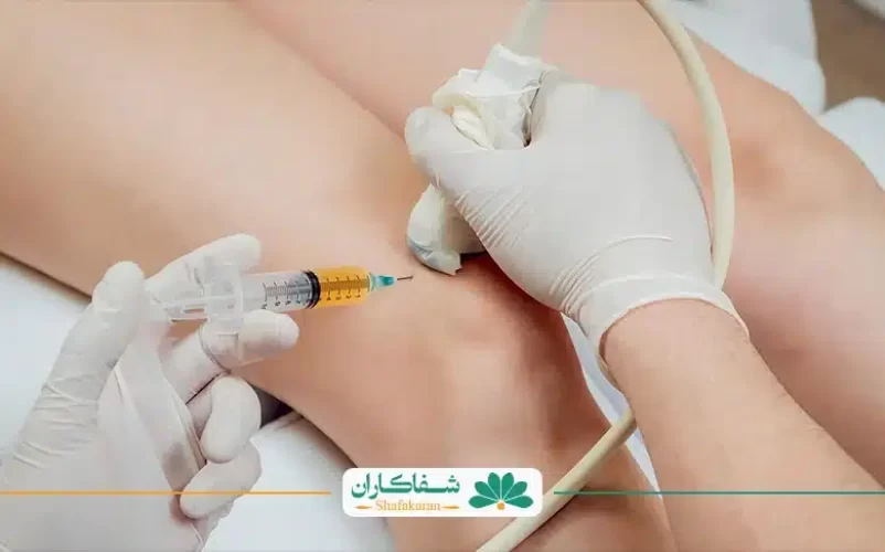 تصویر یاز پی آر پی زانو | شفاکاران